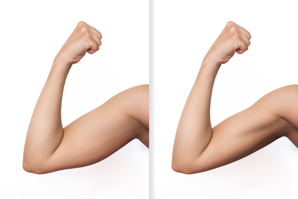 beforeandafterarms