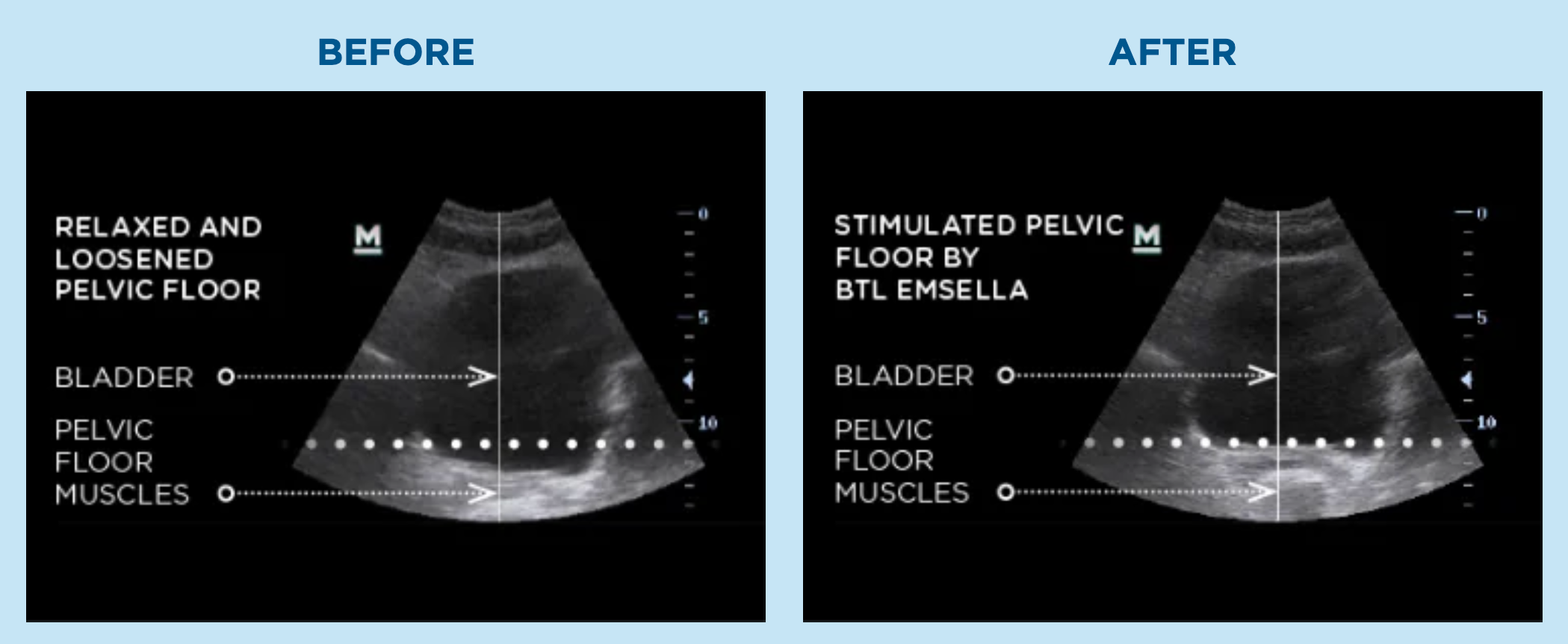 emsellabladderhelp wholesome health function medicine services